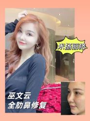 -北京米扬丽格医疗美容·联合丽格鼻整形中心