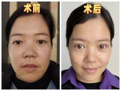 -素美医疗美容·西南眼鼻整形·修复基地