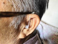 -北京悦听品牌助听器集合店峰力奥迪康斯达克瑞声达(石景山店)