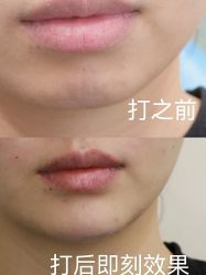 -伊丽莎白医疗美容