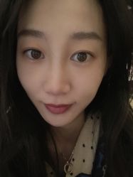 体验后-北京米扬丽格医疗美容·联合丽格鼻整形中心