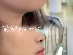 -优诺口腔(华东总院)