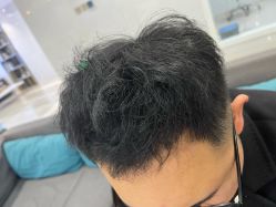 -雍禾植发全国连锁