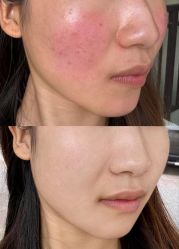 -SKIN79皮肤管理中心