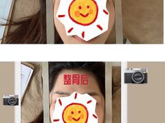 -FACE·日本小颜美容整骨(福田店)