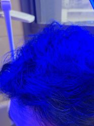 -碧莲盛·不剃发植发