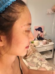 -惠妍美医美整形