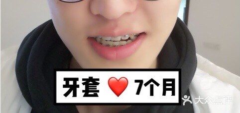 【案例分享】今天我们来讲个小帅哥的正畸案例