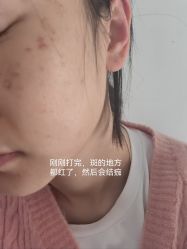 体验后-Yestar杭州艺星医疗美容医院