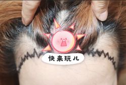 -大麦微针植发全国连锁