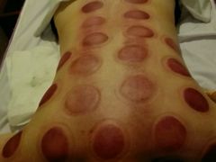 -益友堂盲人推拿正骨穴位按摩工作室