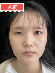 -素美医疗美容·西南眼鼻整形·修复基地