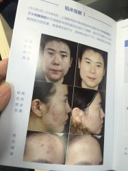 -博乐达水杨酸祛痘皮肤管理中心