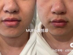 -MUFI·美悦菲塑颜美容SPA