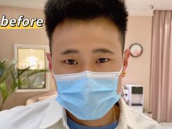 -UP&UP·半永久眉毛眼线机器野生眉