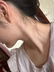 -小忠丽格医美