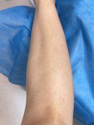 体验后-深圳美莱医疗美容医院