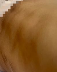 -西安现代妇产医院医疗美容