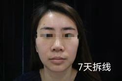 -Yestar宁波艺星整形医院