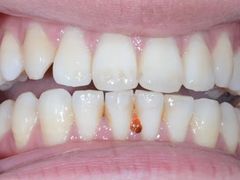 -新达口腔(华东理工大学店)