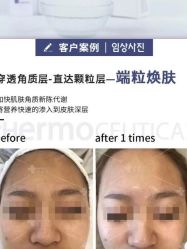 -苗方清颜痘肌研究所