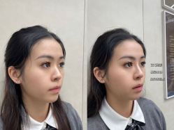 -素美医疗美容·西南眼鼻整形·修复基地