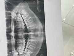 -上海仁爱医院口腔科 · 种植