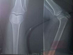 -广州中医药大学第一附属医院(总院)