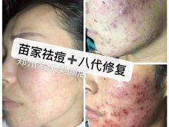 -新苗幼儿园(惠民街店)