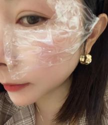 体验前-美安心医美·美迪迈黄金微针·美拉美医疗美容