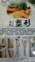 点击看大图 -寇氏拔罐减肥