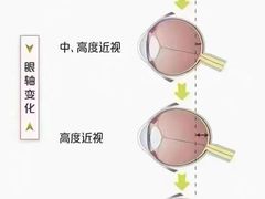 -宝视达眼镜(泌阳店)