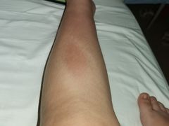 -武汉大学人民医院(首义院区)