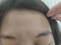 体验后-杭州奥拉克医疗美容门诊部