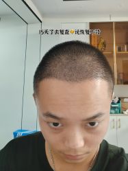 -雍禾植发全国连锁