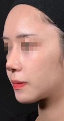 -素美医疗美容·西南眼鼻整形·修复基地