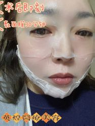 体验后-北京英煌医疗美容