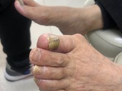 -新甲连锁灰指甲·甲沟炎·鸡眼(黑龙江路店)