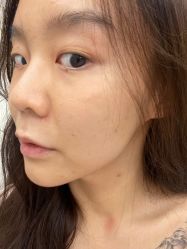 体验前-加减美医美连锁品牌