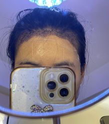 -熙朵美学植发·连锁品牌