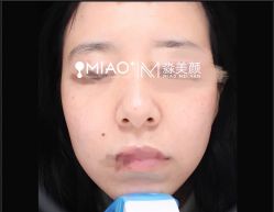 -韩国淼美颜皮肤管理官方直营店