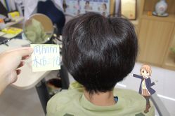 -大麦微针植发丨全国连锁