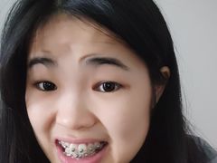 -柏乐口腔(南宁总院)