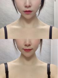 -上海漾颜医疗美容