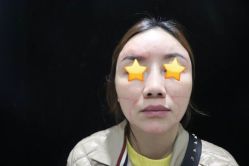 -洁铭新加坡医美