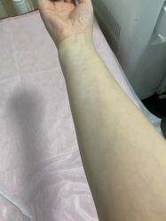 点击看大图 -薇兰专业脱毛连锁机构