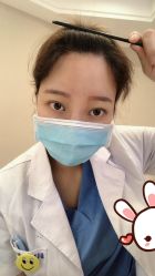 点击看大图 -大麦微针植发丨全国连锁