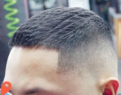 -大麦微针植发丨全国连锁