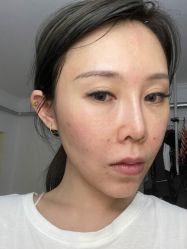 -More摩尔医美の注射线雕光电中心