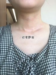 -上海玫瑰医疗美容医院